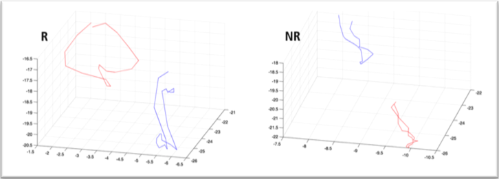 Example of trajectories obtained in an echo-responder patient (R, top panel) and in a non-responder patient (NR, bottom panel) at t<sub>-1</sub> (blue line) and t<sub>0</sub> (red line).